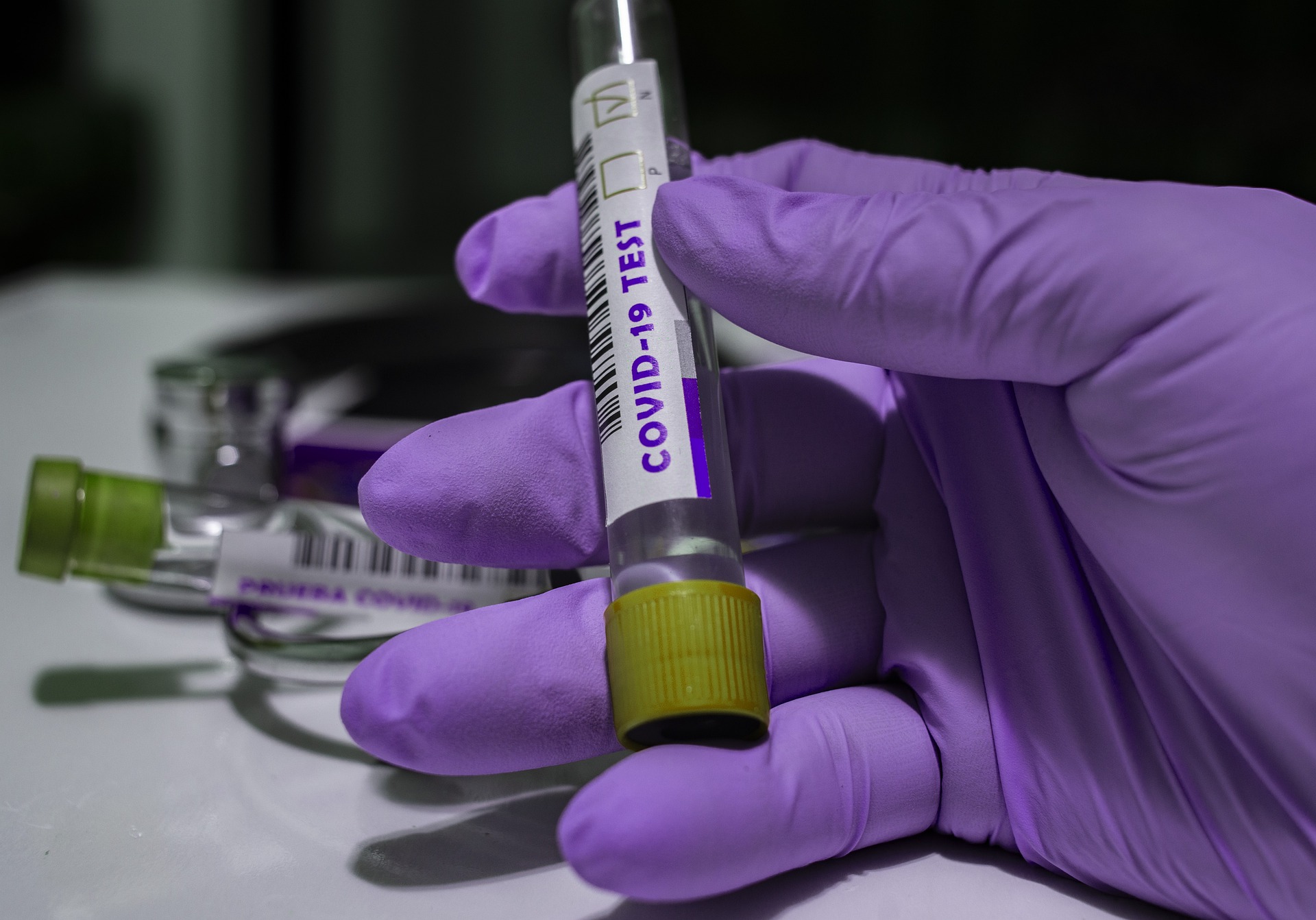 Covid, da aprile cambiano le regole per isolamento e autosorveglianza