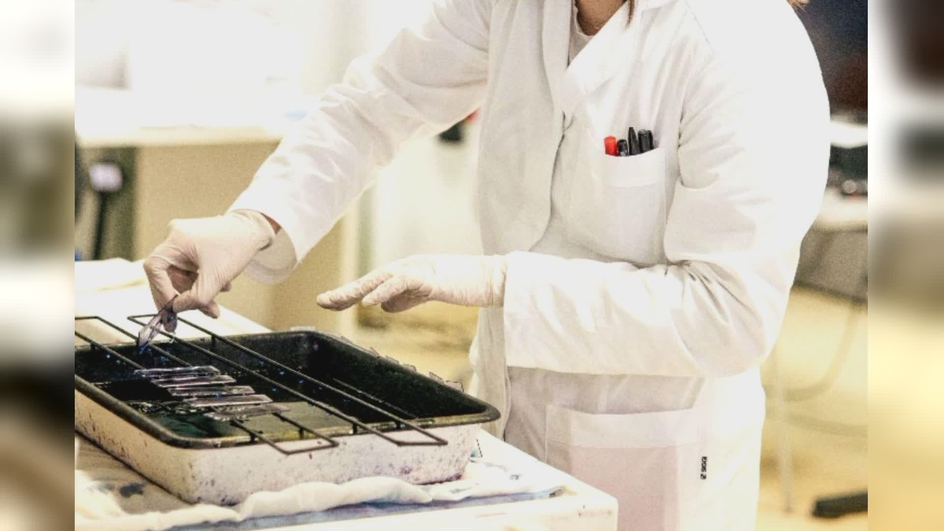 Leucemia, in Liguria diagnosticati oltre 200 casi all'anno