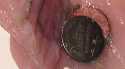 Genova, allarme ingestione pile a bottone: 4 bambini al Gaslini in pochi giorni