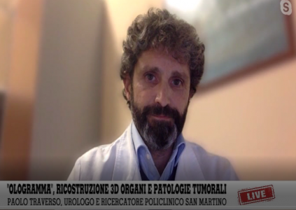 Genova, al San Martino l'ologramma 3D guida interventi patologie renali 