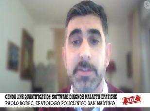 Genova, al San Martino il Genoa Line Quantification: nuovo software per diagnosi del fegato