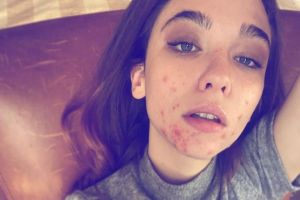 Matilda De Angelis:" Fiera delle mie cicatrici. Non mi importa essere bella"