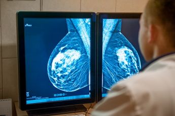 Ripresa screening tumore al seno, Asl4 e 5 insieme per recuperare le liste d'attesa