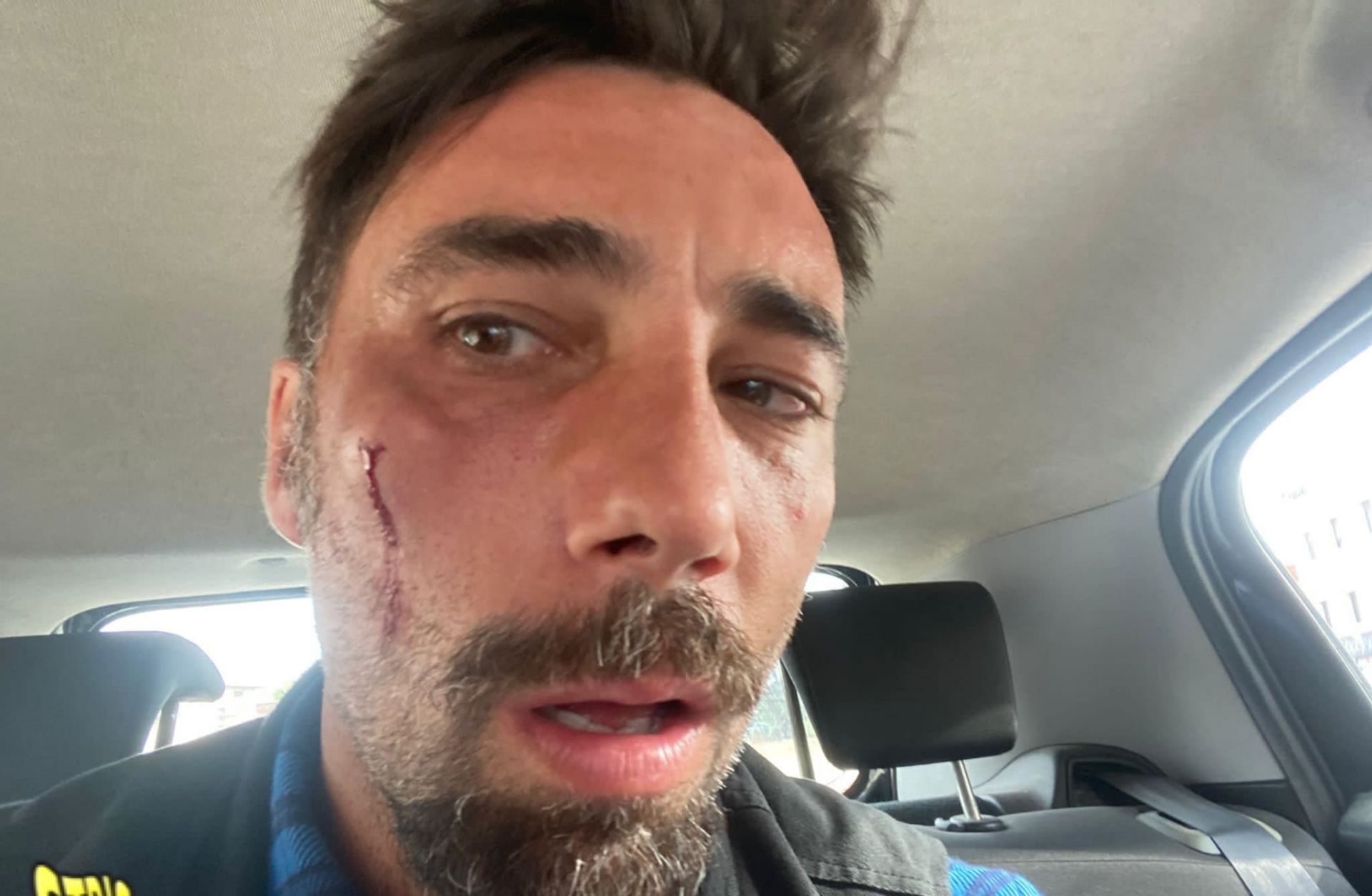 Vittorio Brumotti aggredito e pestato a Foggia: "Non si può far finta di nulla"