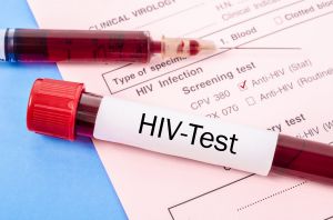 Aids, nuovi casi dimezzati nel 2020: "Effetto delle restrizioni sociali anticovid"