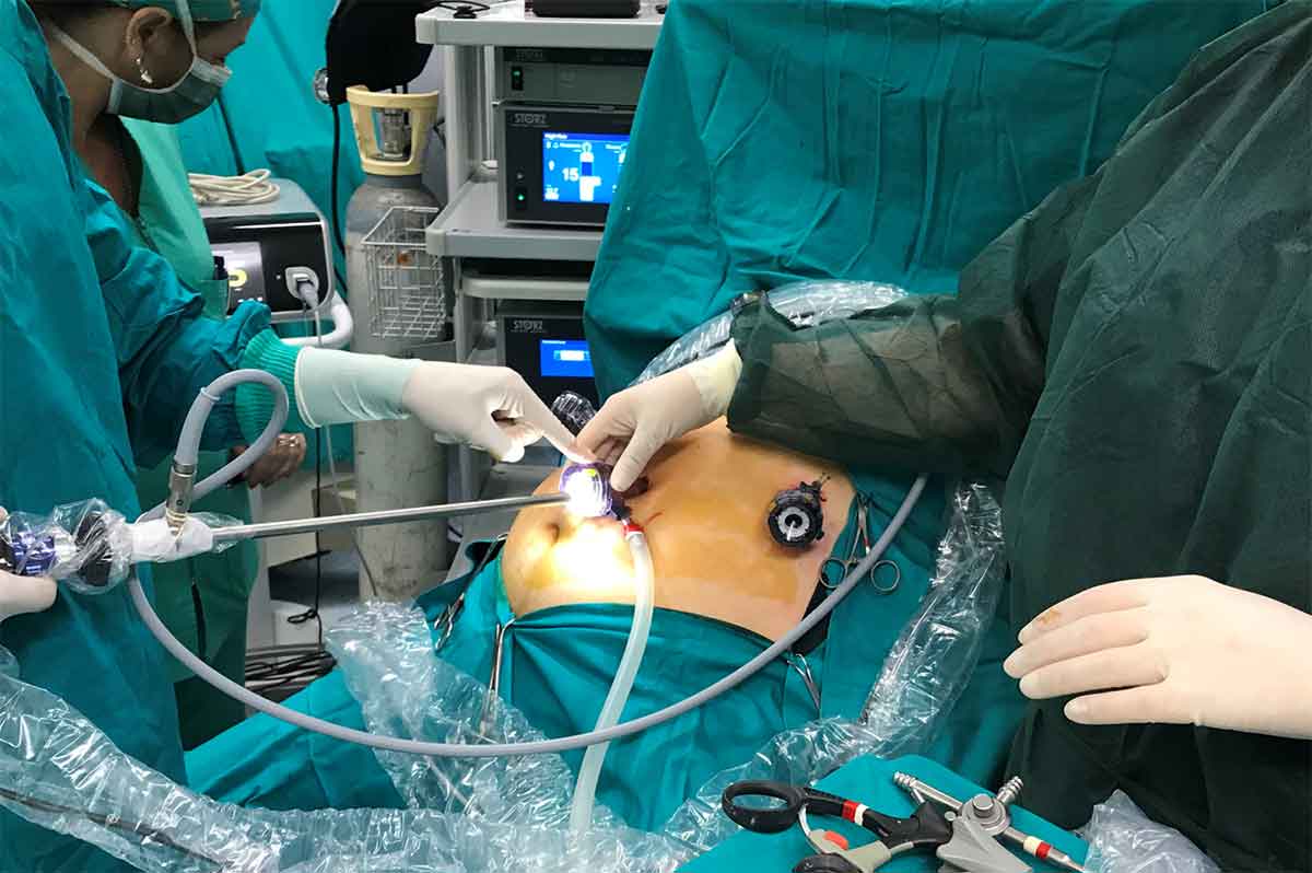 Chirurgia bariatrica, primo intervento in Liguria per ridurre lo stomaco con una clip innovativa