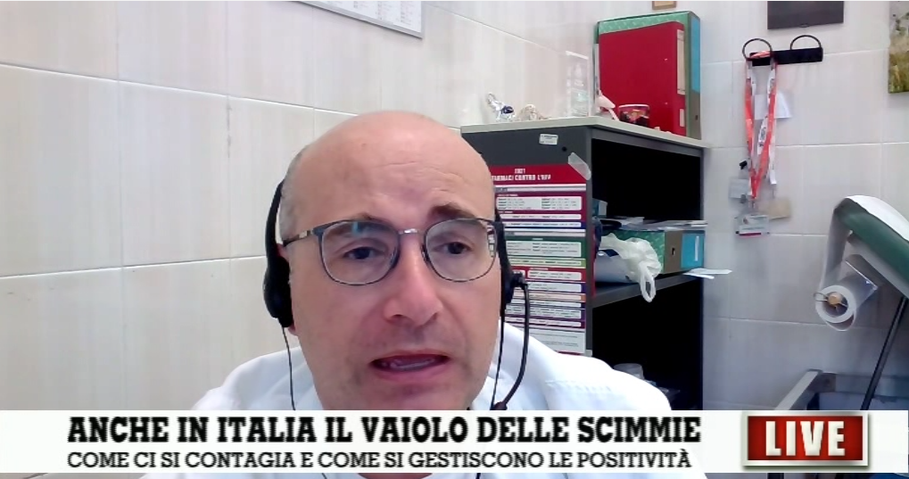 Vaiolo delle scimmie: Pontali "Non è così pericoloso per la popolazione"