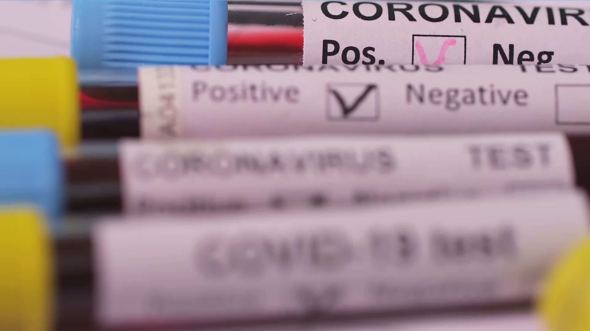 Covid, il prof. Orsi (Istituto di Igiene Unige): "Casi in aumento per gli autotest, ma nessun ricovero per patologie respiratorie"