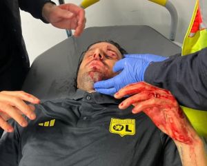 Calcio, incidenti prima di Marsiglia-Lione: pietre contro il bus ospite, Fabio Grosso ferito al volto 
