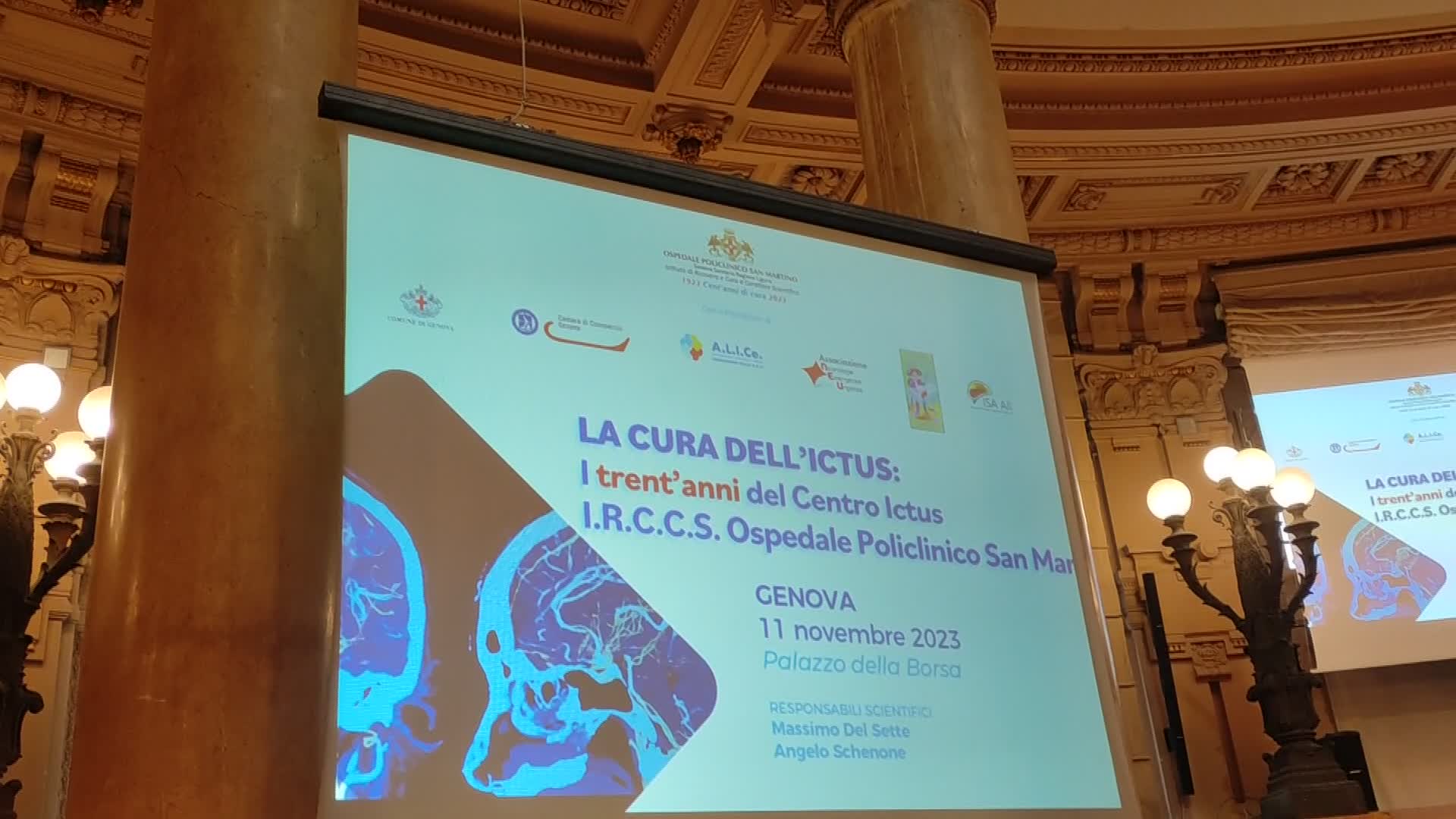 Liguria, ogni anno 4mila casi di ictus: i dati dell'ospedale San Martino