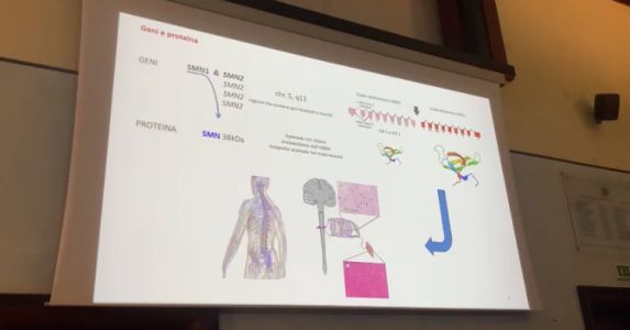 Gaslini, screening neonatale SMA e SCID: nuovo test unico in Italia che ha già salvato la vita a due bambini