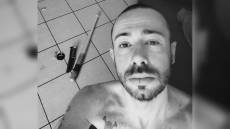 Picchiato in carcere, la prossima settimana nuovo intervento chirurgico al volto per Alberto Scagni