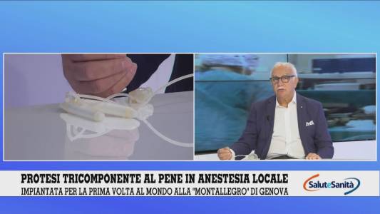 Genova, protesi al pene in anestesia locale. Il professor De Rose: "Intervento complesso ma efficace"