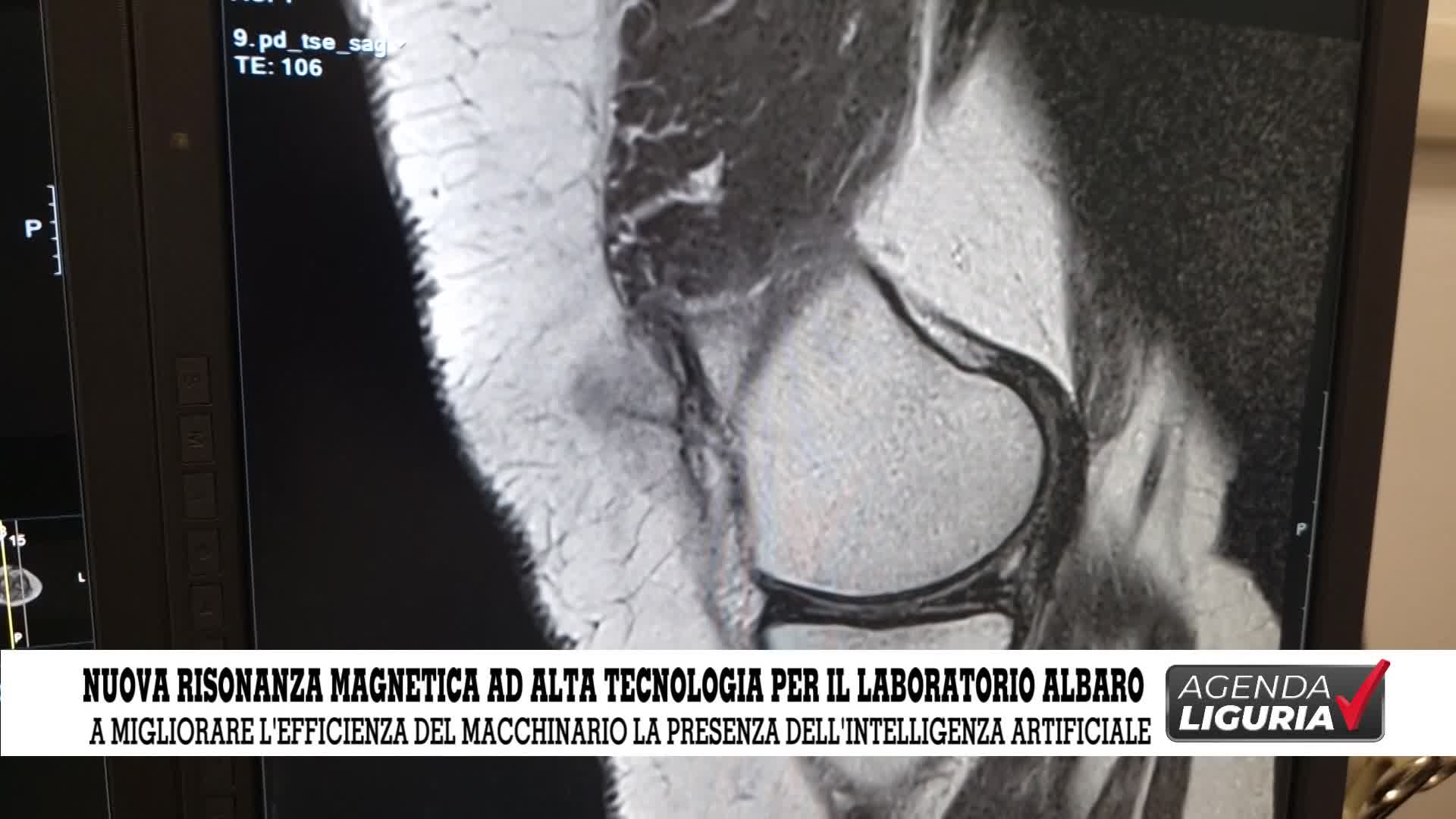 Salute Sanità -Nuova risonanza magnetica ad alta tecnologia per il Laboratorio Albaro 16/04/2024