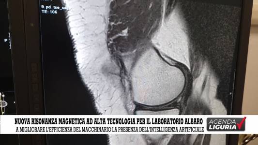 Salute Sanità -Nuova risonanza magnetica ad alta tecnologia per il Laboratorio Albaro 16/04/2024