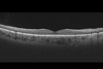 Prevenzione e salute, controlli gratuiti alla Fiera di Sant’Agata per la vista degli over 55