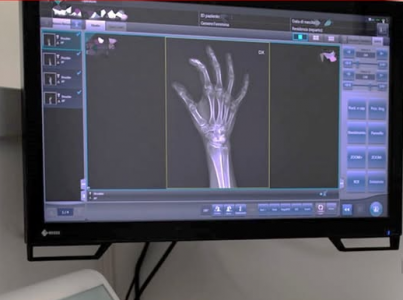 Radiologia con accesso diretto presso IRO Centro Diagnostico dall'8 luglio al 12 agosto