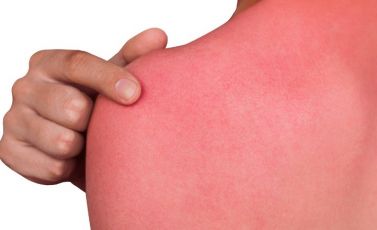 Scottarsi per spopolare sul web, gli occhi della psichiatria sulla folle sfida: "Malsana ricerca di appartenenza fondata sul dolore"