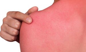 Scottarsi per spopolare sul web, gli occhi della psichiatria sulla folle sfida: "Malsana ricerca di appartenenza fondata sul dolore"