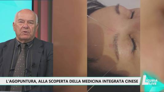 Agopuntura, alla scoperta dell'antica medicina integrata cinese