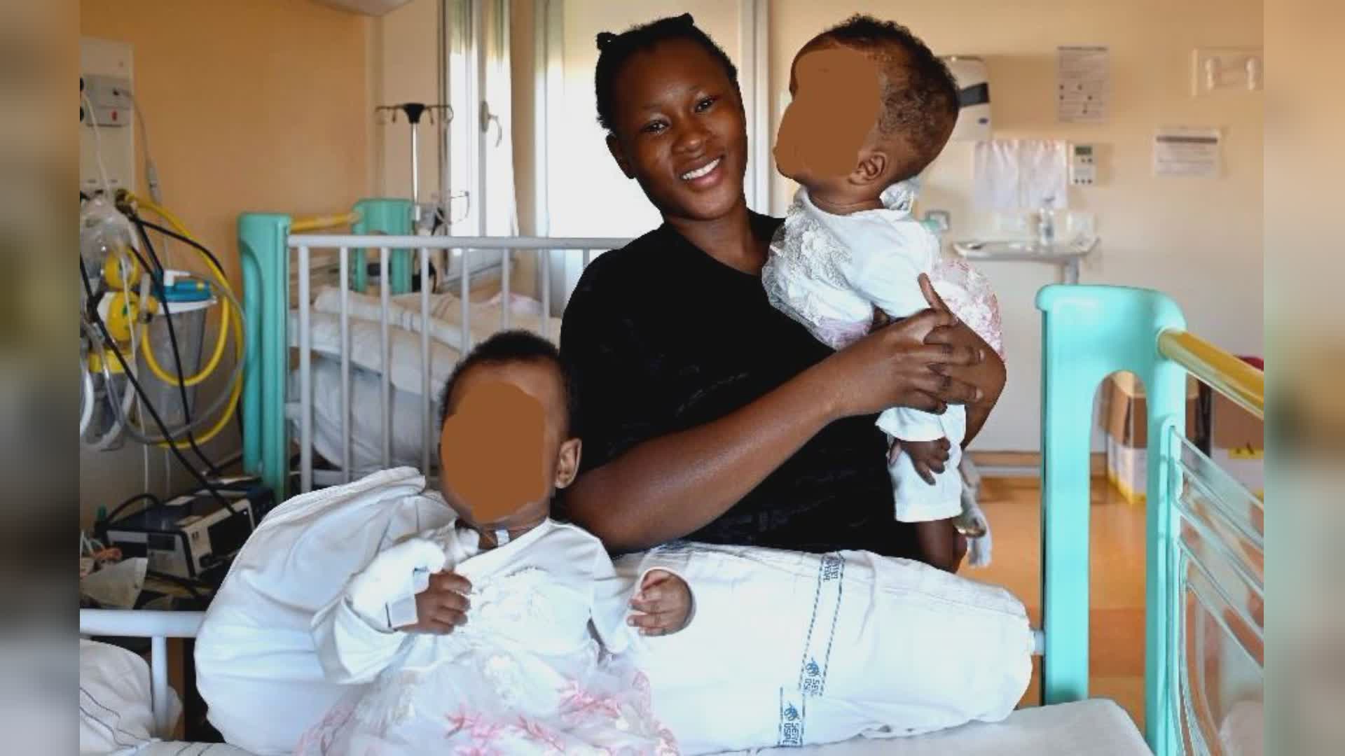 Gaslini: le gemelline siamesi operate con successo il 6 giugno tornano a casa in Burkina Faso