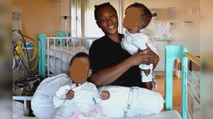 Gaslini: le gemelline siamesi operate con successo il 6 giugno tornano a casa in Burkina Faso