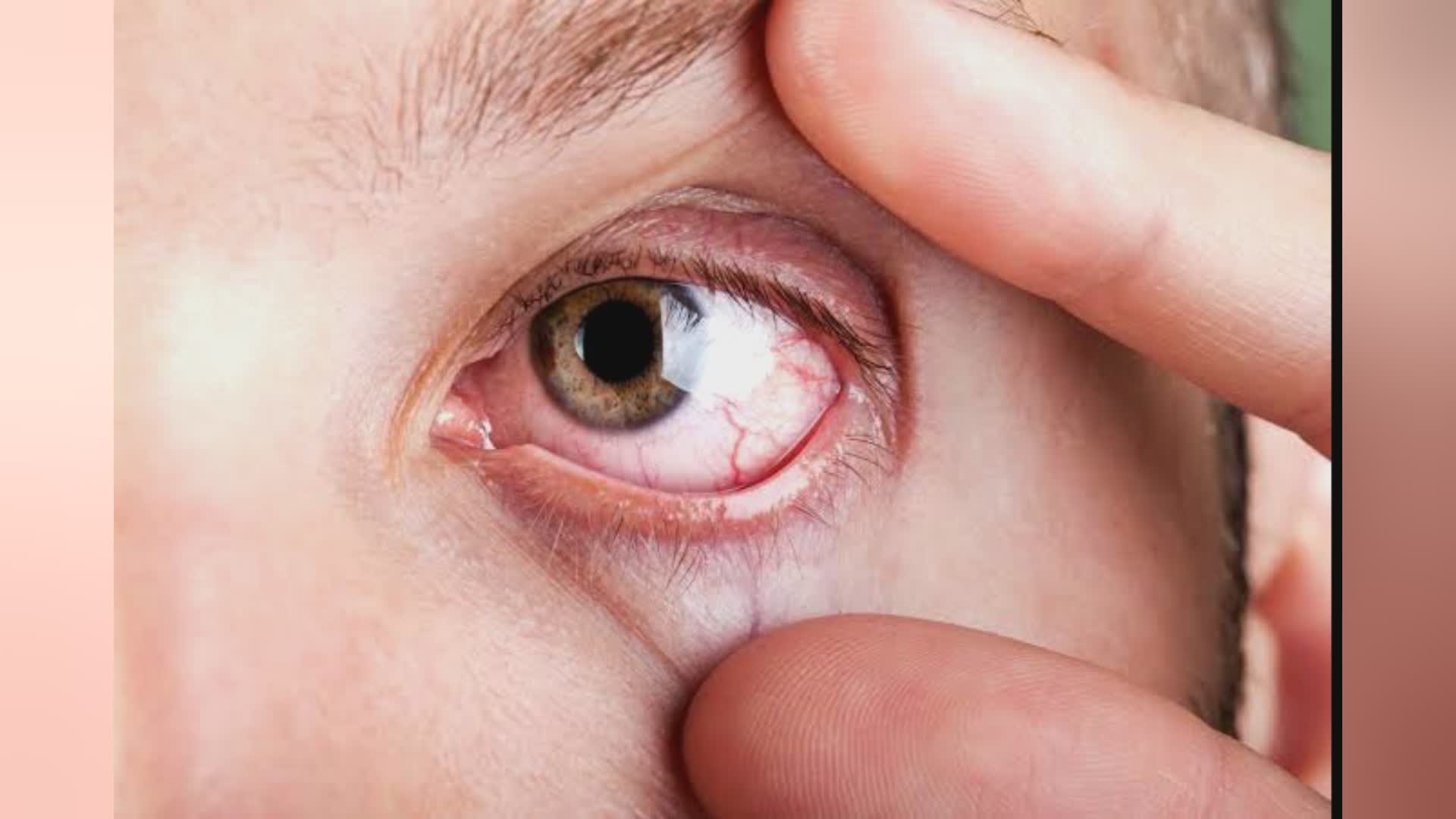 Maculopatia, la Liguria istituisce la giornata della sensibilizzazione